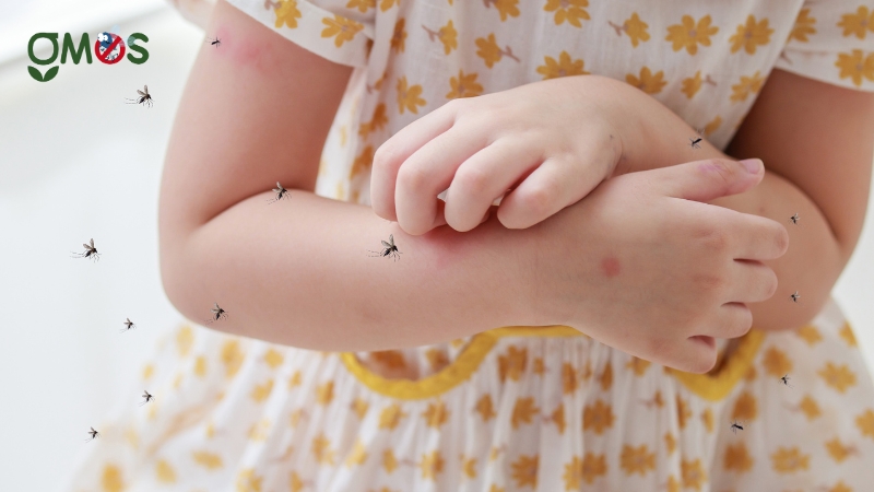 Hướng dẫn 5 cách đuổi muỗi tự nhiên hiệu quả