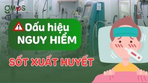 Dấu hiệu của bệnh sốt xuất huyết
