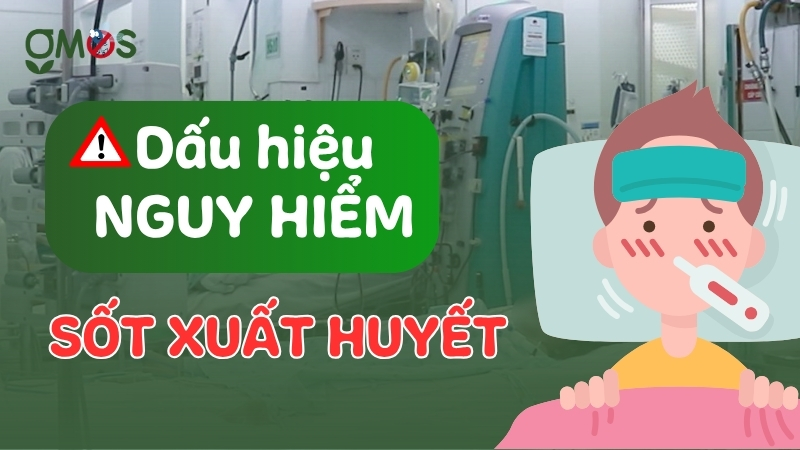 Dấu hiệu của bệnh sốt xuất huyết