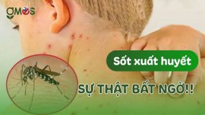 Sốt xuất huyết là gì ? Tìm hiểu nguyên nhân và cách phòng tránh !